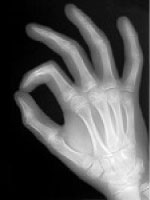 Oリングテストイメージ